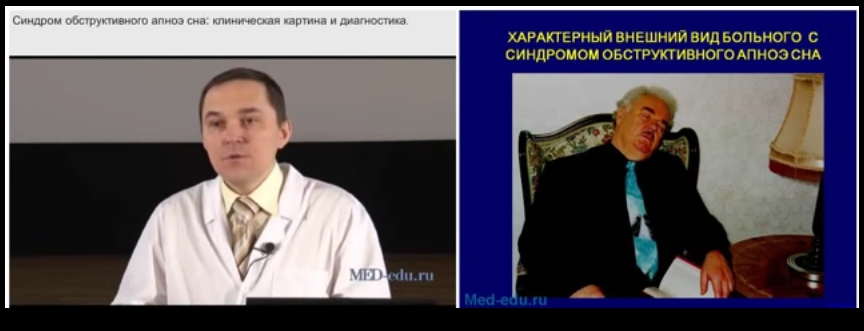 АПНОЭ сна.jpg АПНОЭ сна.jpg